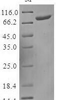 Human Killer cell immunoglobulin-like receptor 2DS3 (KIR2DS3), partial Recombinant Protein, N-MBP/C-His - BioCrest Sci