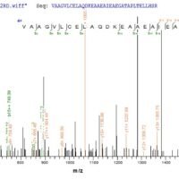 Human Catenin beta-1 (CTNNB1) Recombinant Protein, N-GST - BioCrest Sci