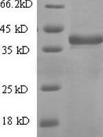 Human T-cell antigen CD7 (CD7), partial Recombinant Protein, N-His-SUMO - BioCrest Sci