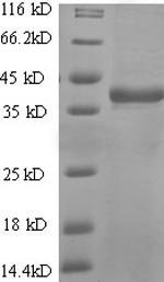 Human T-cell antigen CD7 (CD7), partial Recombinant Protein, N-His-SUMO, Homo sapiens (Human), E.coli, N-terminal 6xHis-SUMO-tagged, 32.4 kDa, purity >≥ 90% as determined by SDS-PAGE.