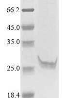 Human Cathepsin O (CTSO) Recombinant Protein - BioCrest Sci