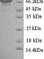 Human Toll-like receptor 8 (TLR8), partial Recombinant Protein - BioCrest Sci