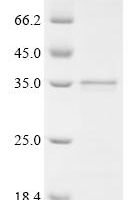 Human Suppression of tumorigenicity 18 protein (ST18), partial Recombinant Protein - BioCrest Sci