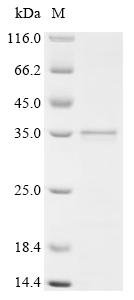 Human Suppression of tumorigenicity 18 protein (ST18), partial Recombinant Protein, Homo sapiens (Human), E.coli, N-terminal 10xHis-tagged and C-terminal Myc-tagged, 23.4 kDa, purity >≥ 85% as determined by SDS-PAGE.