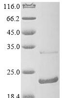 Mouse Anterior gradient protein 2 homolog (Agr2) Recombinant Protein, N-10His/C-Myc - BioCrest Sci