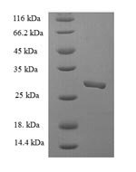 Rotavirus A Non-structural glycoprotein 4, partial Recombinant Protein, N-His-SUMO - BioCrest Sci