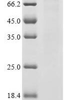 Human Pseudouridylate synthase PUS7L (PUS7L) Recombinant Protein, C-His, aa 1–701, Baculovirus - BioCrest Sci