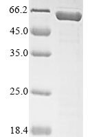 Mouse Serine protease inhibitor A3N (Serpina3n) Recombinant Protein, N-His-SUMO, aa 21–418, Purity ≥85% - BioCrest Sci