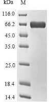 Pyrococcus horikoshii L-aspartate oxidase (nadB) Recombinant Protein - BioCrest Sci