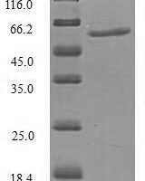 Human Importin subunit alpha-5 (KPNA1), partial Recombinant Protein - BioCrest Sci