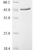 Human Hepatoma-derived growth factor (HDGF) Recombinant Protein - BioCrest Sci