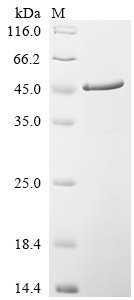 Human Hepatoma-derived growth factor (HDGF) Recombinant Protein, Homo sapiens (Human), E.coli, C-terminal 6xHis-tagged, 33.7 kDa, purity >≥ 85% as determined by SDS-PAGE.