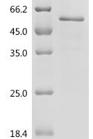 Human Myc proto-oncogene protein (MYC) Recombinant Protein, Tag-Free - BioCrest Sci