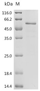 Human Myc proto-oncogene protein (MYC) Recombinant Protein, Tag-Free, Homo sapiens (Human), E.coli, Tag-Free, 48.9 kDa, purity >≥ 85% as determined by SDS-PAGE.