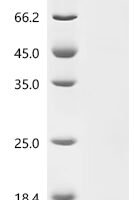 Epstein-Barr virus Protein BMRF2 (BMRF2), partial Recombinant Protein, C-His, aa 180–217, E.coli - BioCrest Sci