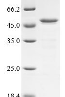 Pseudomonas aeruginosa Serralysin (aprA), partial Recombinant Protein - BioCrest Sci