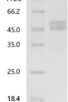 Human Tumor necrosis factor ligand superfamily member 10 (TNFSF10), partial Recombinant Protein, C-mFc2a - BioCrest Sci