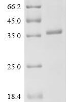 Avian sarcoma virus Tyrosine-protein kinase transforming protein Src (V-SRC), partial Recombinant Protein, C-His - BioCrest Sci