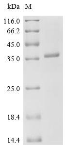 Avian sarcoma virus Tyrosine-protein kinase transforming protein Src (V-SRC), partial Recombinant Protein, C-His, Avian sarcoma virus (strain PR2257), E.coli, C-terminal 6xHis-tagged, 36.0 kDa, purity >≥ 85% as determined by SDS-PAGE.