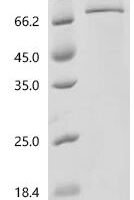 Cat Albumin (ALB) Recombinant Protein, C-His, aa 25–608, E.coli - BioCrest Sci