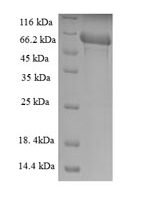 Mouse Transmembrane protease serine 4 (Tmprss4), partial Recombinant Protein - BioCrest Sci