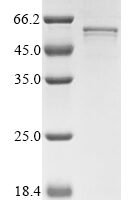 Mouse Collagen alpha-1 (XXVI) chain (Col26a1) Recombinant Protein - BioCrest Sci