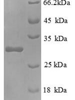 Mouse Interleukin-2 receptor subunit beta (Il2rb), partial Recombinant Protein - BioCrest Sci
