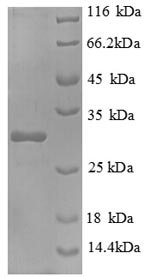 Mouse Interleukin-2 receptor subunit beta (Il2rb), partial Recombinant Protein, Mus musculus (Mouse), E.coli, N-terminal 6xHis-tagged, 29.0 kDa, purity >≥ 90% as determined by SDS-PAGE.