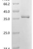 Aspergillus oryzae Probable pectate lyase E (plyE) Recombinant Protein - BioCrest Sci