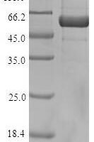 Arabidopsis thaliana  Arabidopsis thaliana (AUR1) Recombinant Protein - BioCrest Sci