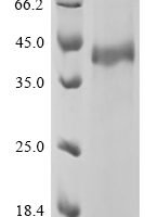 Human TGF-beta receptor type-1 (TGFBR1), partial Recombinant Protein - BioCrest Sci