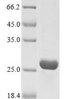 Human Insulin-like growth factor 1 receptor (IGF1R), partial Recombinant Protein, N-His, aa 763–931, E.coli - BioCrest Sci