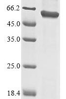 Human E3 ubiquitin-protein ligase TRAIP (TRAIP) Recombinant Protein, N-10His - BioCrest Sci