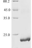 Rat Pleiotrophin (Ptn) Recombinant Protein - BioCrest Sci
