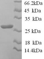 Sheep Interleukin-12 subunit beta (IL12B) Recombinant Protein, N-His, aa 23–327, Yeast - BioCrest Sci