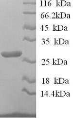 Sheep Interleukin-12 subunit beta (IL12B) Recombinant Protein, N-His, aa 23–327, Yeast, Ovis aries (Sheep), Yeast, N-terminal 6xHis-tagged, 36.5 kDa, purity >≥ 90% as determined by SDS-PAGE.