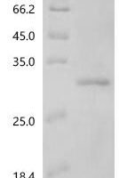 Bovine Galectin (LGALS3) Recombinant Protein - BioCrest Sci