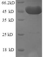 Mouse Tryptophan 2,3-dioxygenase (Tdo2) Recombinant Protein - BioCrest Sci