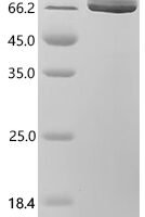Human Phosphoglucomutase (PGM2) Recombinant Protein, C-10His - BioCrest Sci