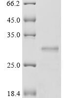 Human Erythroferrone (ERFE), partial Recombinant Protein, N-His-SUMOstar - BioCrest Sci