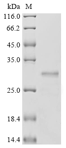 Human Erythroferrone (ERFE), partial Recombinant Protein, N-His-SUMOstar, Homo sapiens (Human), Yeast, N-terminal 6xHis-sumostar-tagged, 30.5 kDa, purity >≥ 90% as determined by SDS-PAGE.