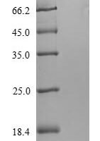 Mycobacterium tuberculosis 6 kDa early secretory antigenic target (esxA), partial Recombinant Protein - BioCrest Sci