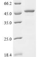 Human Sharpin (SHARPIN) Recombinant Protein - BioCrest Sci