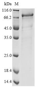 Human coronavirus NL63 Spike glycoprotein (S), partial Recombinant Protein, N-His-SUMOstar, Human coronavirus NL63 (HCoV-NL63), Yeast, N-terminal 6xHis-sumostar-tagged, 28.1 kDa, purity >≥ 90% as determined by SDS-PAGE.