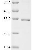Bothrops atrox Thrombin-like enzyme batroxobin Recombinant Protein - BioCrest Sci