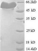 Mouse H-2 class I histocompatibility antigen, K-D alpha chain (H2-K1), partial Recombinant Protein - BioCrest Sci
