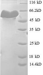 Mouse H-2 class I histocompatibility antigen, K-D alpha chain (H2-K1), partial Recombinant Protein, Mus musculus (Mouse), E.coli, N-terminal GST-tagged, 60.0 kDa, purity >≥ 90% as determined by SDS-PAGE.