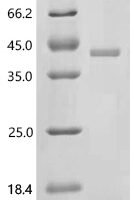 Human MHC class I polypeptide-related sequence B (MICB), partial Recombinant Protein, C-His, aa 23–309 - BioCrest Sci
