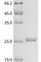 Mycobacterium bovis Cell surface glycolipoprotein MPB83 (mpb83), Biotinylated Recombinant Protein - BioCrest Sci