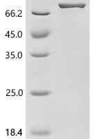Escherichia coli DNA helicase II (uvrD) Recombinant Protein - BioCrest Sci